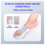 Komfortowy separator palców u stóp Lekka i dopasowana konstrukcja do codziennej pielęgnacji stóp